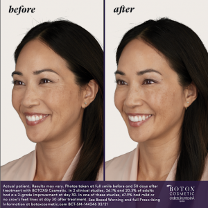 BOTOX | Qualimed Aesthetics Services